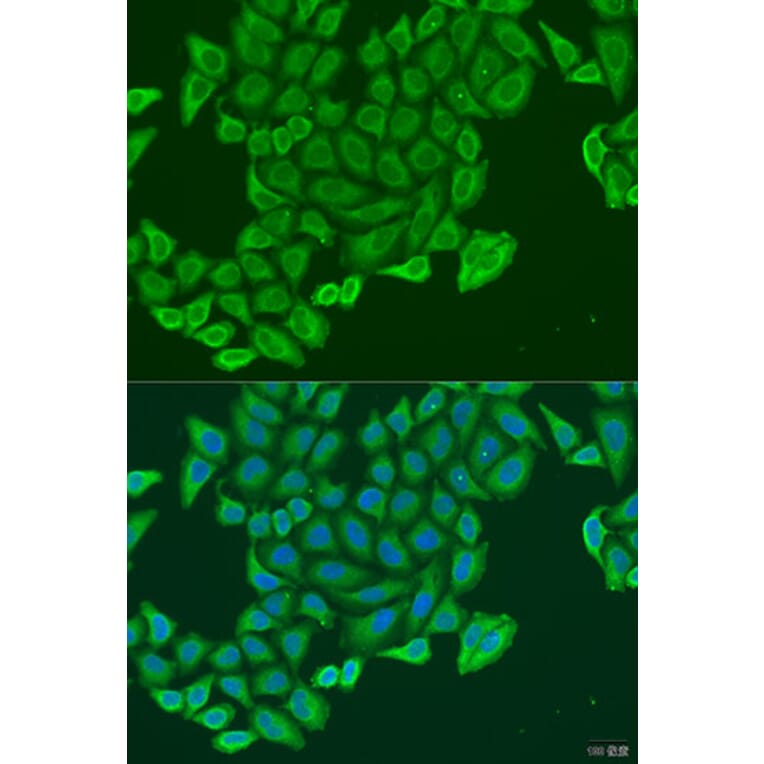 Immunofluorescence - Anti-EXOC2 Antibody (A8235) - Antibodies.com