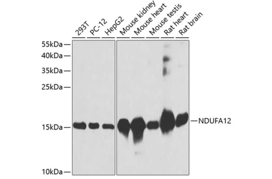 Western Blot - Anti-NDUFA12 Antibody (A8237) - Antibodies.com