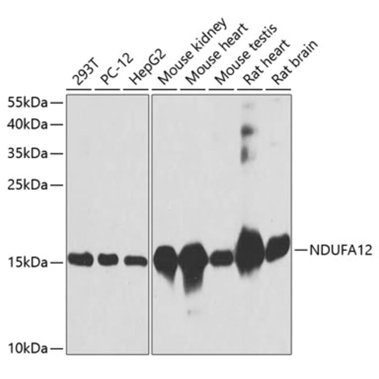 Western Blot - Anti-NDUFA12 Antibody (A8237) - Antibodies.com
