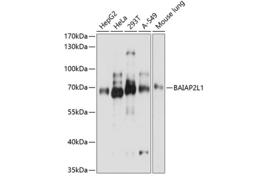 Western Blot - Anti-BAIAP2L1/IRTKS Antibody (A16122) - Antibodies.com