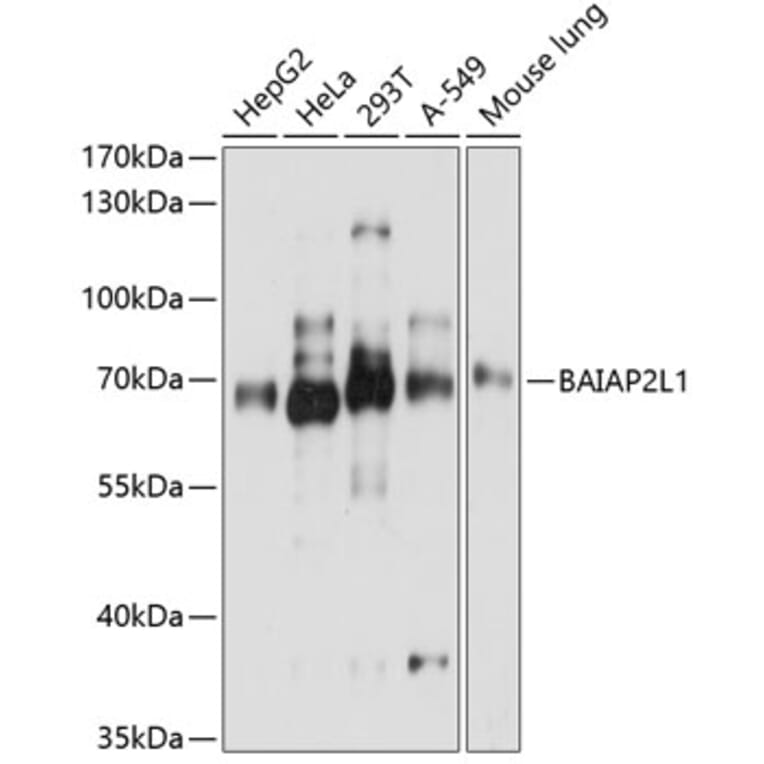 Western Blot - Anti-BAIAP2L1/IRTKS Antibody (A16122) - Antibodies.com