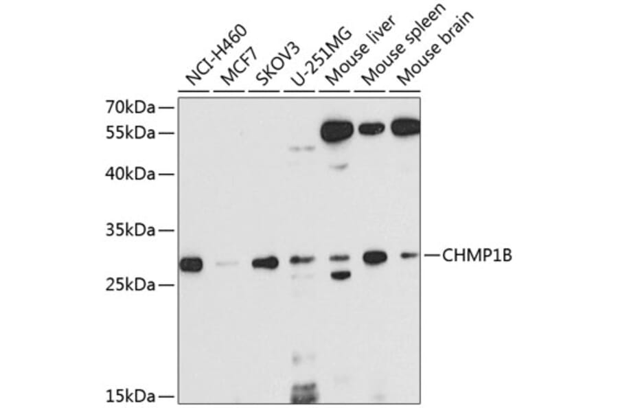 Western Blot - Anti-CHMP1B Antibody (A16123) - Antibodies.com