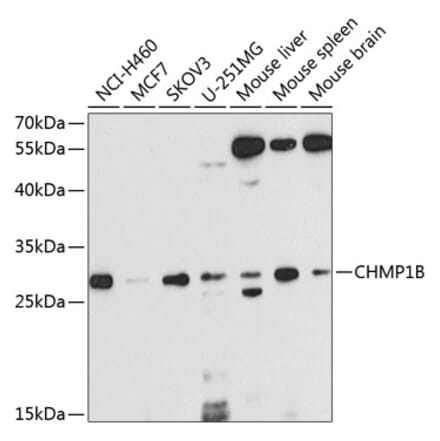 Western Blot - Anti-CHMP1B Antibody (A16123) - Antibodies.com