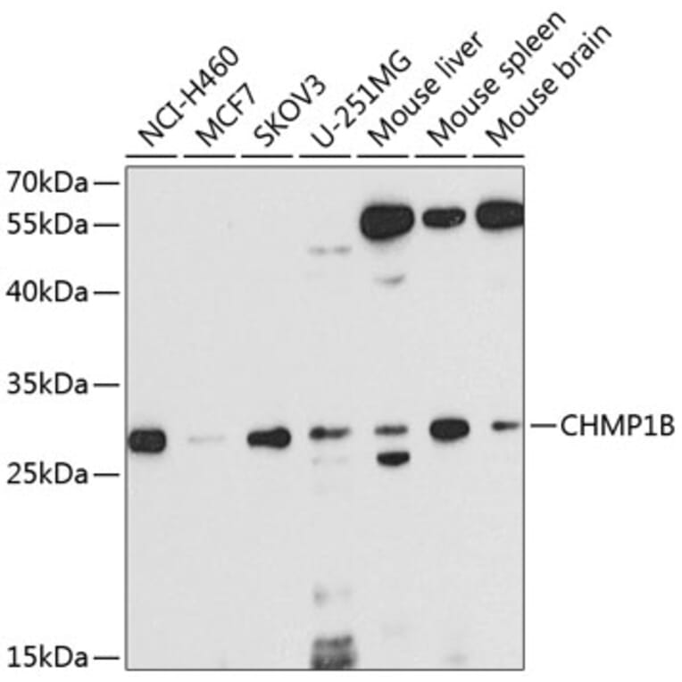 Western Blot - Anti-CHMP1B Antibody (A16123) - Antibodies.com