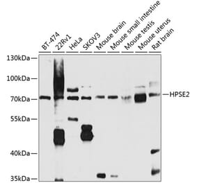 Western Blot - Anti-HPSE2 Antibody (A16126) - Antibodies.com