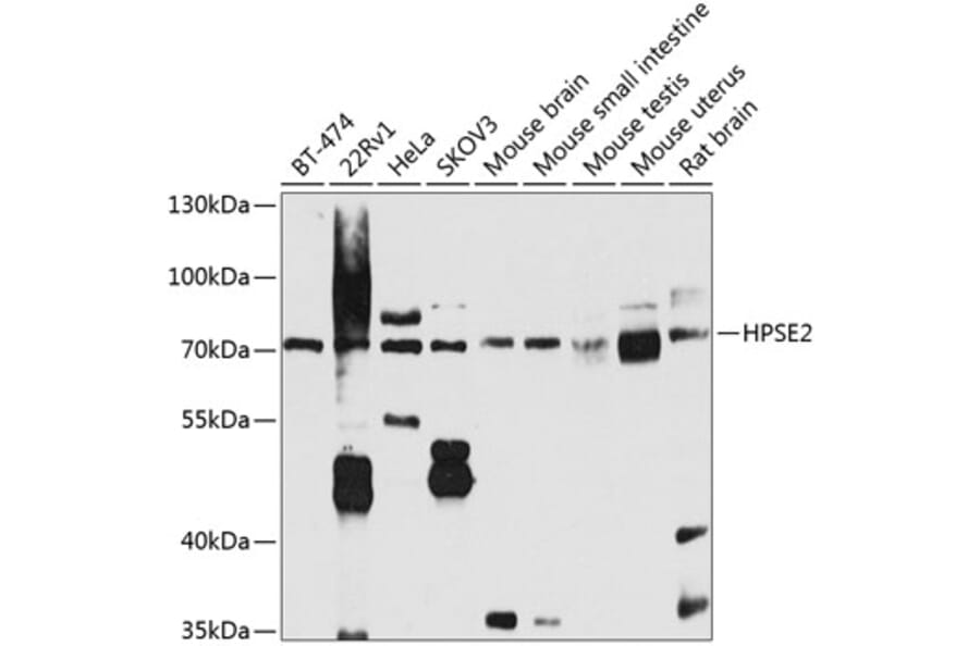 Western Blot - Anti-HPSE2 Antibody (A16126) - Antibodies.com