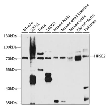 Western Blot - Anti-HPSE2 Antibody (A16126) - Antibodies.com