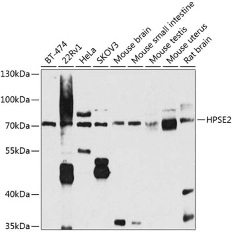 Western Blot - Anti-HPSE2 Antibody (A16126) - Antibodies.com