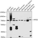 Western Blot - Anti-HPSE2 Antibody (A16126) - Antibodies.com