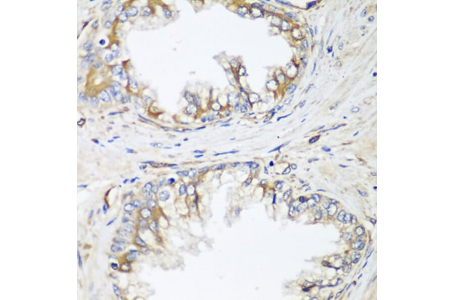 Immunohistochemistry - Anti-HPSE2 Antibody (A16126) - Antibodies.com