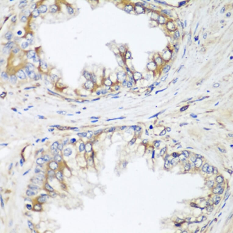 Immunohistochemistry - Anti-HPSE2 Antibody (A16126) - Antibodies.com