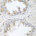 Immunohistochemistry - Anti-HPSE2 Antibody (A16126) - Antibodies.com