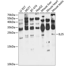 Western Blot - Anti-IL-25 Antibody (A16129) - Antibodies.com