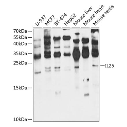 Western Blot - Anti-IL-25 Antibody (A16129) - Antibodies.com