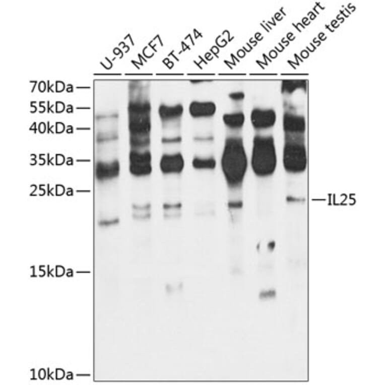 Western Blot - Anti-IL-25 Antibody (A16129) - Antibodies.com