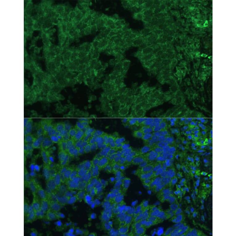 Immunofluorescence - Anti-IL-25 Antibody (A16129) - Antibodies.com