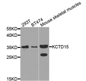 Western Blot - Anti-KCTD15 Antibody (A8256) - Antibodies.com