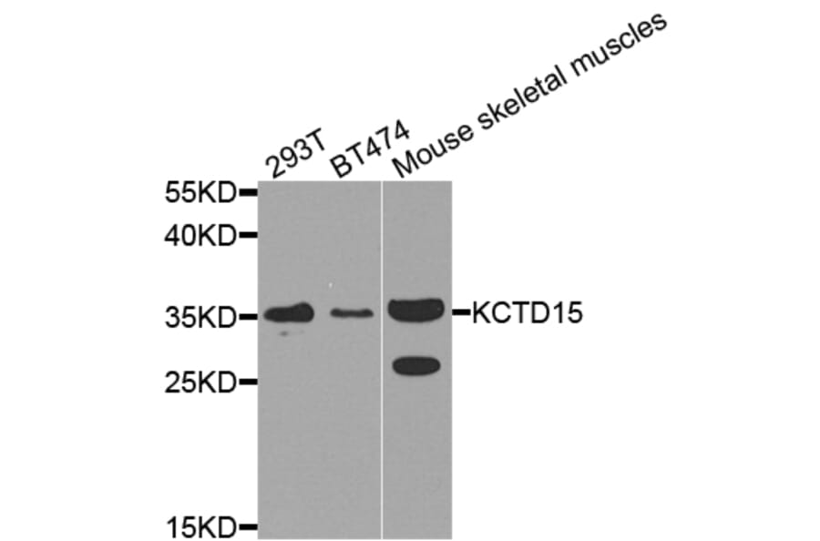 Western Blot - Anti-KCTD15 Antibody (A8256) - Antibodies.com
