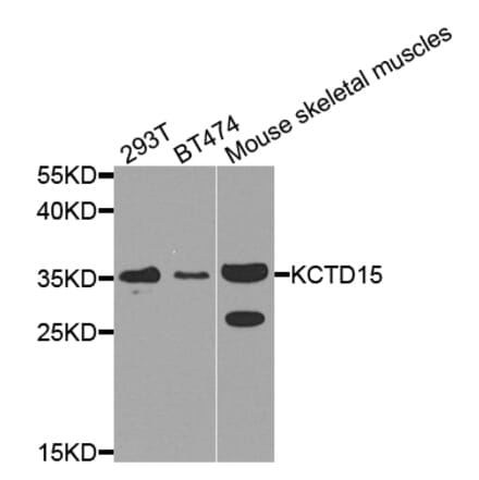 Western Blot - Anti-KCTD15 Antibody (A8256) - Antibodies.com