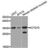 Western Blot - Anti-KCTD15 Antibody (A8256) - Antibodies.com