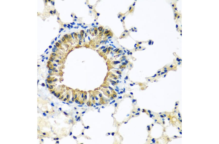 Immunohistochemistry - Anti-KCTD15 Antibody (A8256) - Antibodies.com