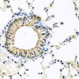 Immunohistochemistry - Anti-KCTD15 Antibody (A8256) - Antibodies.com