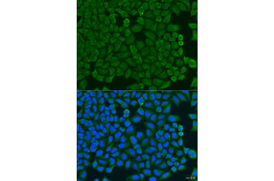 Immunofluorescence - Anti-KCTD15 Antibody (A8256) - Antibodies.com