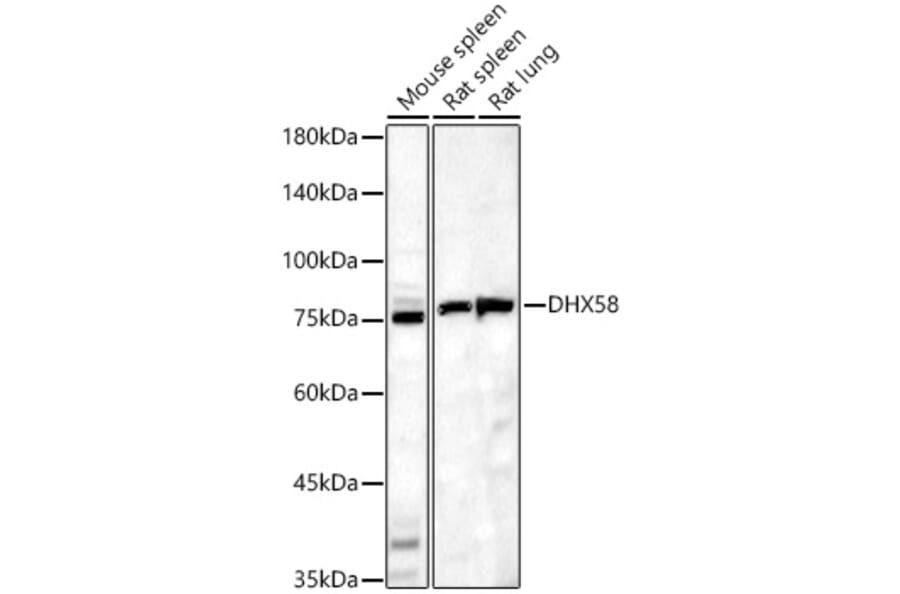 Western Blot - Anti-DHX58/RLR Antibody (A16132) - Antibodies.com