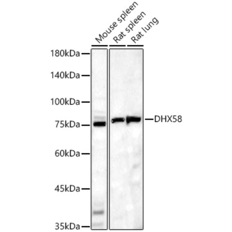 Western Blot - Anti-DHX58/RLR Antibody (A16132) - Antibodies.com