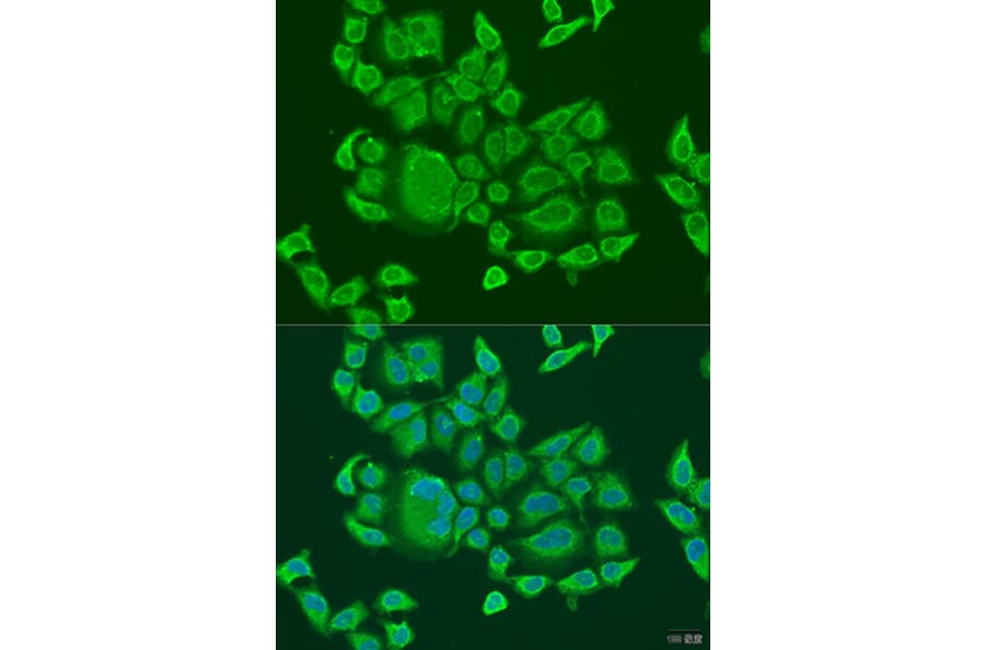 Immunofluorescence - Anti-DHX58/RLR Antibody (A16132) - Antibodies.com