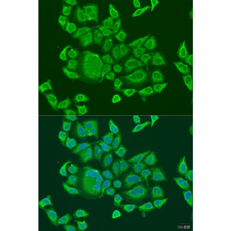 Immunofluorescence - Anti-DHX58/RLR Antibody (A16132) - Antibodies.com
