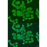 Immunofluorescence - Anti-DHX58/RLR Antibody (A16132) - Antibodies.com