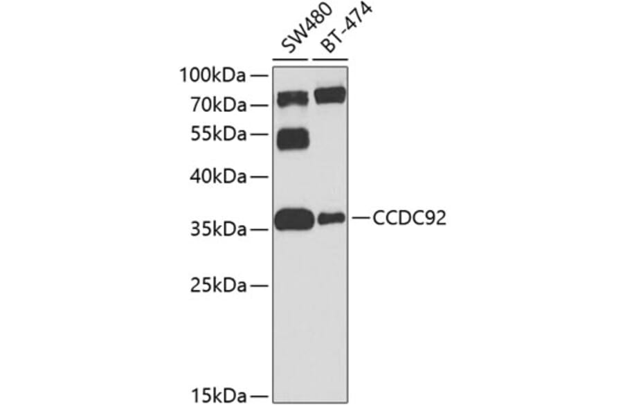 Western Blot - Anti-CCDC92 Antibody (A16133) - Antibodies.com