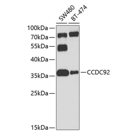 Western Blot - Anti-CCDC92 Antibody (A16133) - Antibodies.com