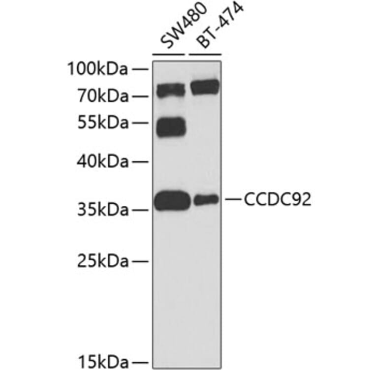 Western Blot - Anti-CCDC92 Antibody (A16133) - Antibodies.com