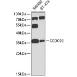 Western Blot - Anti-CCDC92 Antibody (A16133) - Antibodies.com