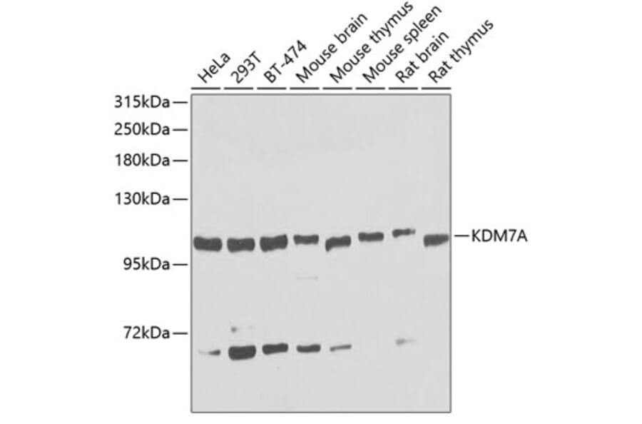 Western Blot - Anti-KDM7A/JHDM1D Antibody (A16134) - Antibodies.com