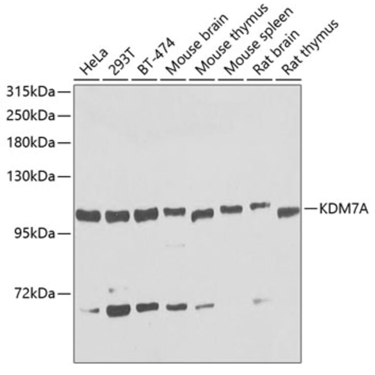Western Blot - Anti-KDM7A/JHDM1D Antibody (A16134) - Antibodies.com
