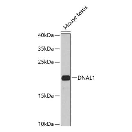 Western Blot - Anti-DNAL1 Antibody (A16135) - Antibodies.com