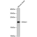 Western Blot - Anti-DNAL1 Antibody (A16135) - Antibodies.com