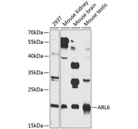 Western Blot - Anti-ARL6 Antibody (A16137) - Antibodies.com