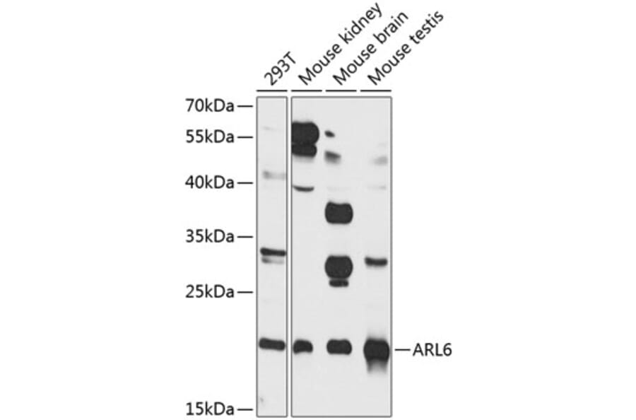 Western Blot - Anti-ARL6 Antibody (A16137) - Antibodies.com