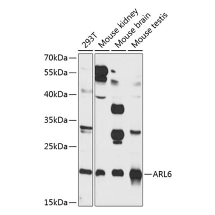 Western Blot - Anti-ARL6 Antibody (A16137) - Antibodies.com