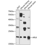 Western Blot - Anti-ARL6 Antibody (A16137) - Antibodies.com