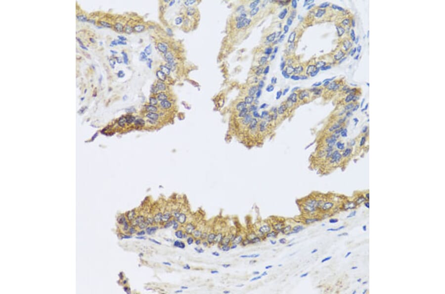 Immunohistochemistry - Anti-ARL6 Antibody (A16137) - Antibodies.com
