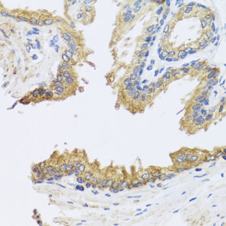 Immunohistochemistry - Anti-ARL6 Antibody (A16137) - Antibodies.com