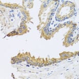 Immunohistochemistry - Anti-ARL6 Antibody (A16137) - Antibodies.com