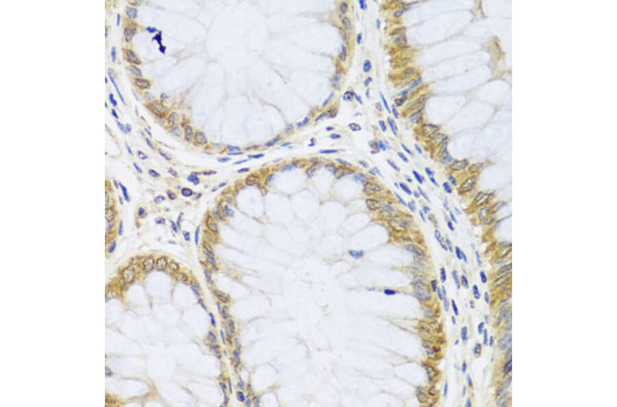 Immunohistochemistry - Anti-ARL6 Antibody (A16137) - Antibodies.com