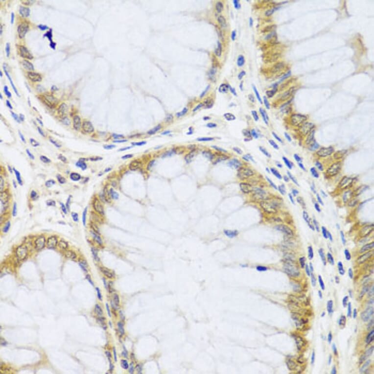 Immunohistochemistry - Anti-ARL6 Antibody (A16137) - Antibodies.com