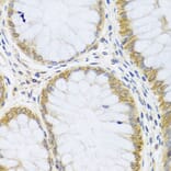 Immunohistochemistry - Anti-ARL6 Antibody (A16137) - Antibodies.com